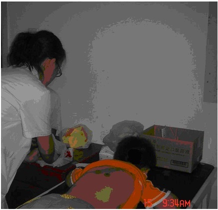 “三伏”贴敷疗法头伏第一天贴敷近千名患儿